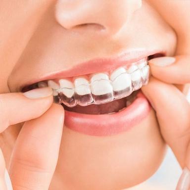 Invisalign clear aligners image